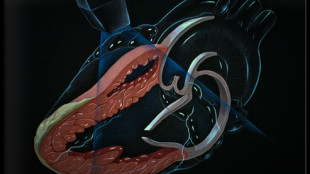 трехмерная проекция сердца человека и отмеченное расположение датчика во время процедуры чреспищеводной эхокардиографии