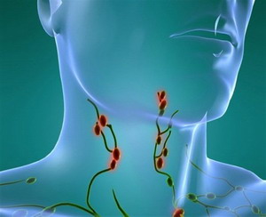 3д проекция головы мужчины с отеченными зеленым лимфатическими сосудами и отмеченными красным лимфоузлами