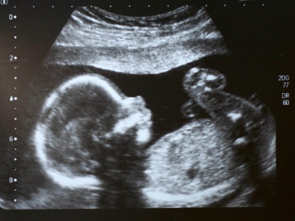 Изображение ребенка во 2 триместре беременности