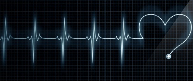 схематичное изображение сердечного ритма