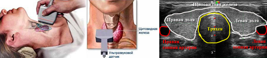Процесс обследования и УЗИ-изображение на экране щитовидной железы