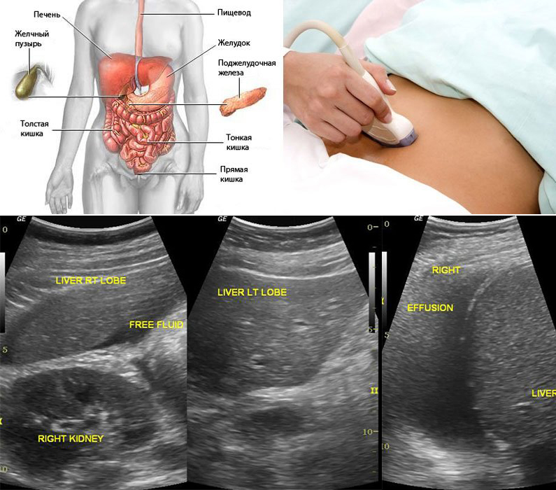 Обследование органов брюшной полости с выводом УЗИ-изображения на экран