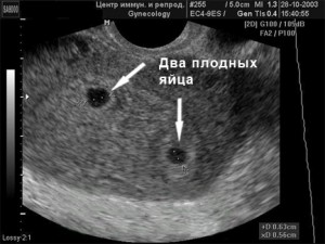 На каком сроке беременности можно увидеть на узи плодное яйцо thumbnail