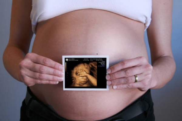 Фото ребенка на 34 неделе беременности