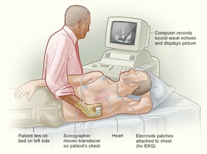Специалист осуществляет процедуру эхокардиограммы сердца